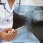 Spine Pain