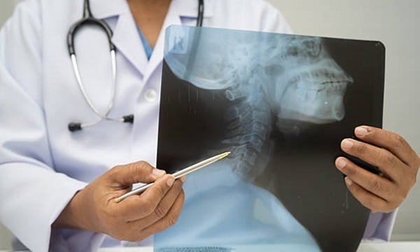 Spine Pain