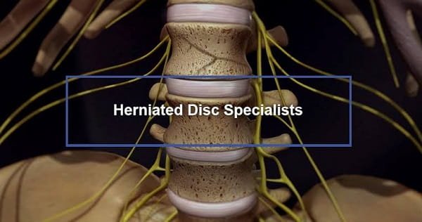 2 Herniated Disc